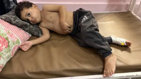 Tragic Wait: Gaza's Children Suffering Amid Medical Evacuations