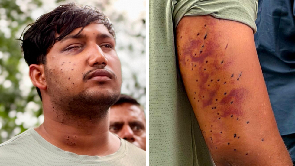 Pellet Gun Fire in Delhi Protest Leaves Protesters with Lead Pellets