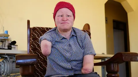 Election-Related Violence: The Ongoing Threat to People with Albinism in Tanzania